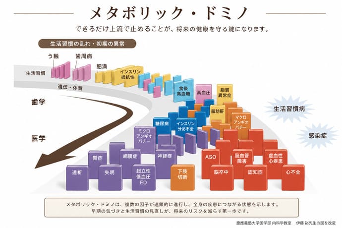 長崎県北松浦郡てらさき歯科ブログメタボリック・ドミノ